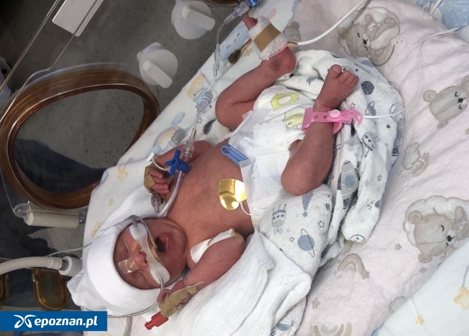 Jedna z urodzonych w styczniu dziewczynek | fot. Ginekologiczno Położniczy Szpital Kliniczny przy ul. Polnej FB