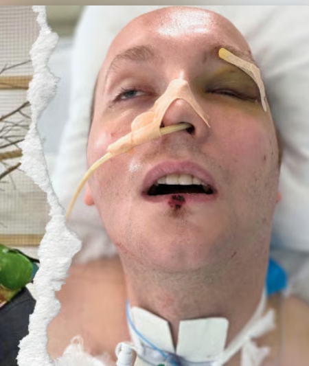 Miał w tym roku zdać maturę i wziąć ślub. Wypadek motocyklowy pokrzyżował mu plany. Trafił na OIOM niemal cały połamany