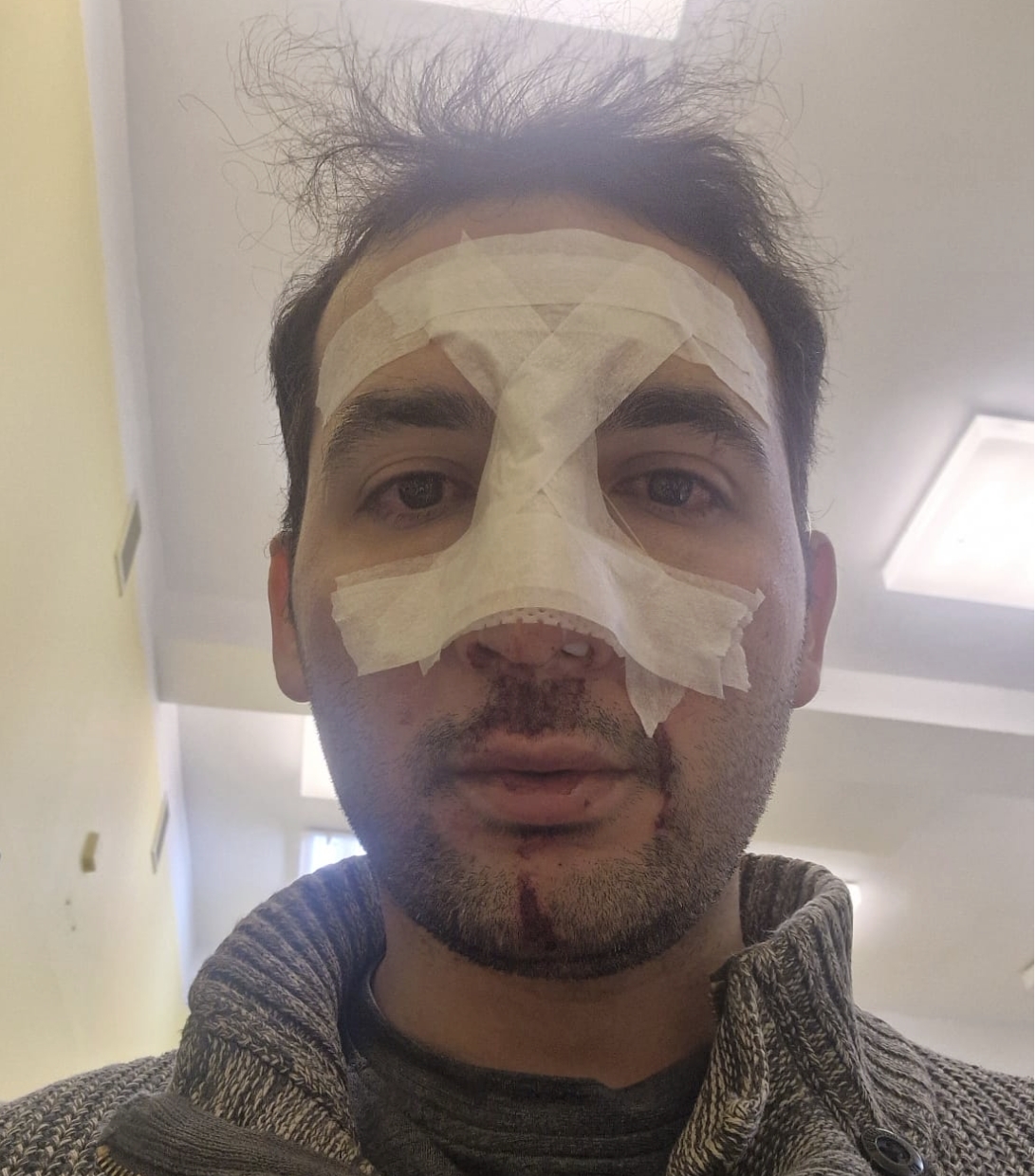 Właściciel kebaba pobity. "Klient nie chciał zrozumieć, iż najpierw musi zapłacić, dopiero potem przygotowujemy danie"