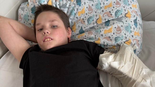 11-latek wypadł z okna szkoły specjalnej w Gnieźnie. Jest zbiórka na leczenie