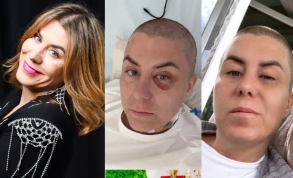 Jedna diagnoza zmieniła wszystko. Mieszkanka Lubonia zbiera na walkę z glejakiem