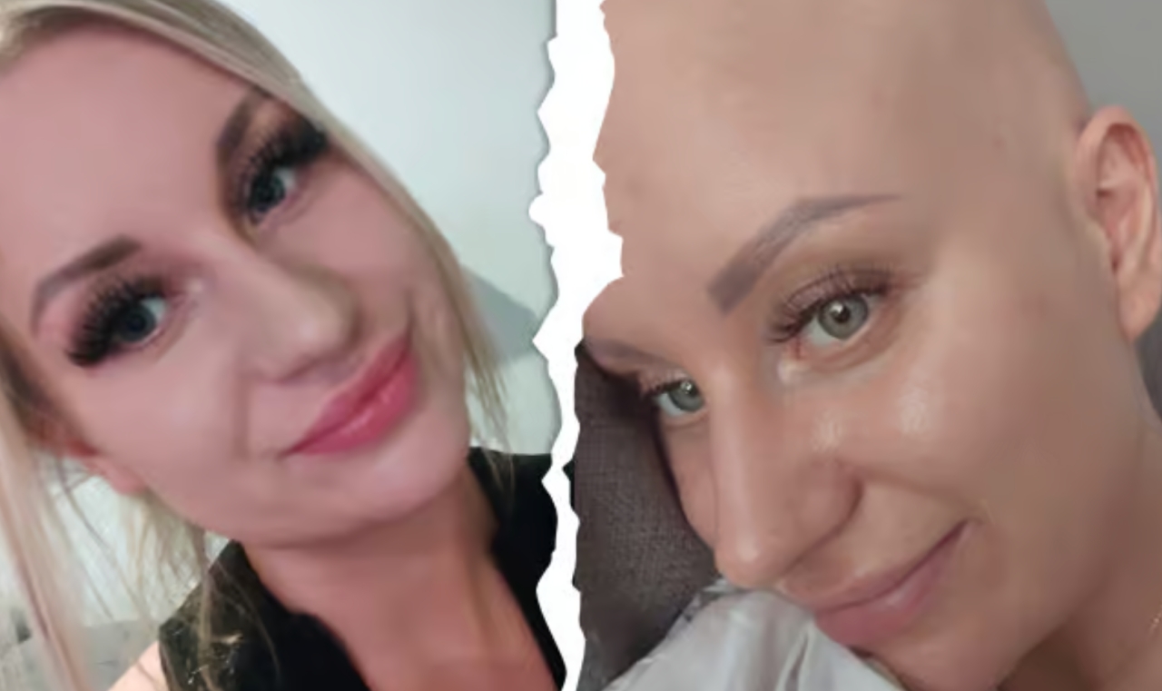 Poznanianka walczy z nowotworem. Jest zbiórka