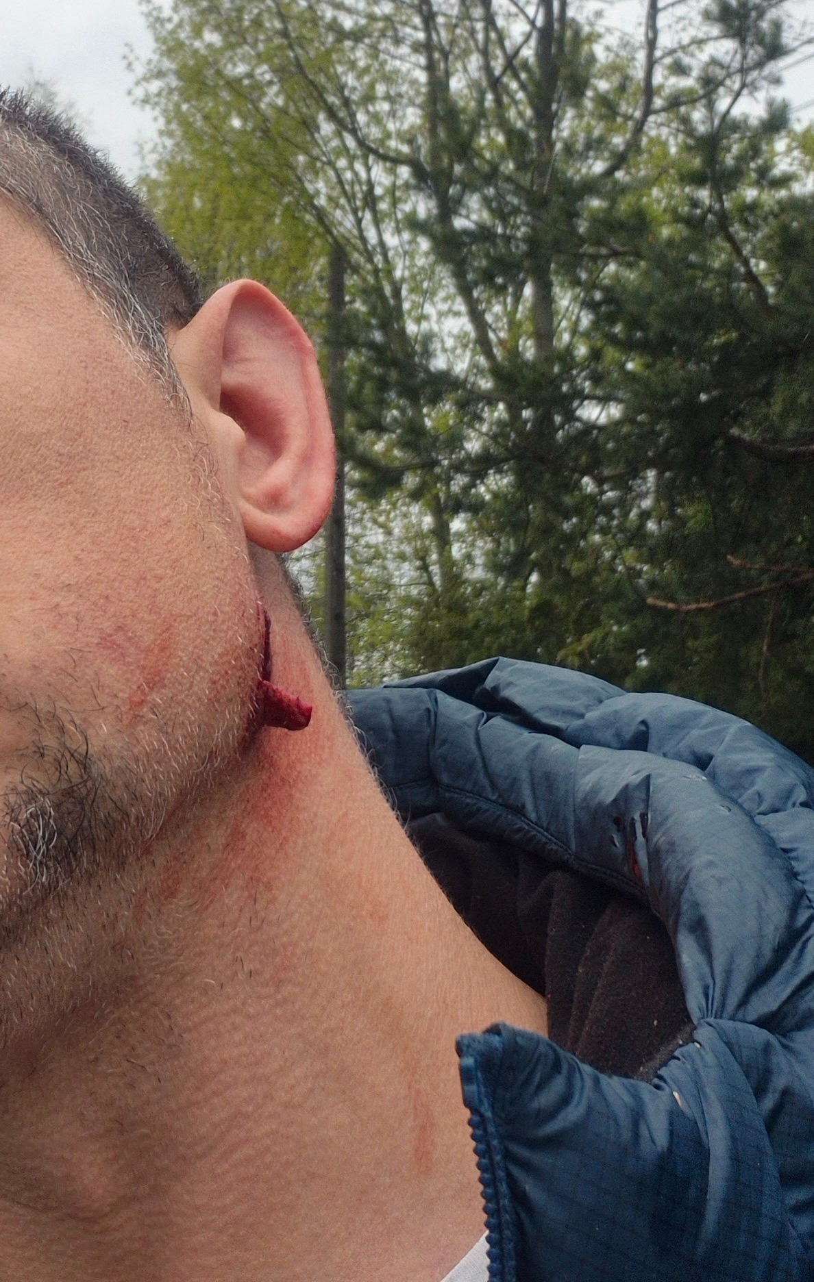 Podjazdowa: krwawa jatka na ulicy. Kierowca zwrócił uwagę pieszemu, który szedł środkiem ulicy. Pieszy ugryzł kierowcę